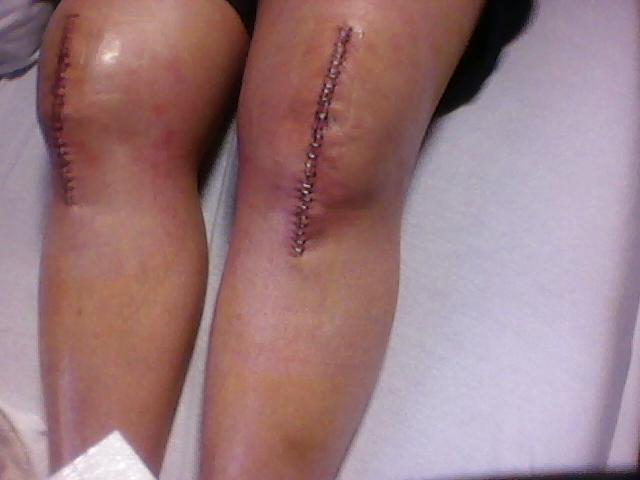 knee-2.jpg